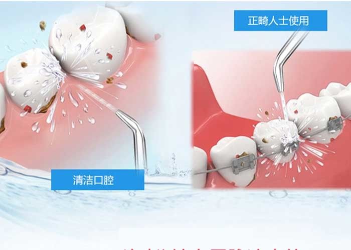 High Frequency Personal Care Products 3 Modes Electric Dental Cleaning Devices